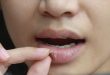 Cara Mengatasi Bibir Kering : Rahasia untuk Senyum Menawan