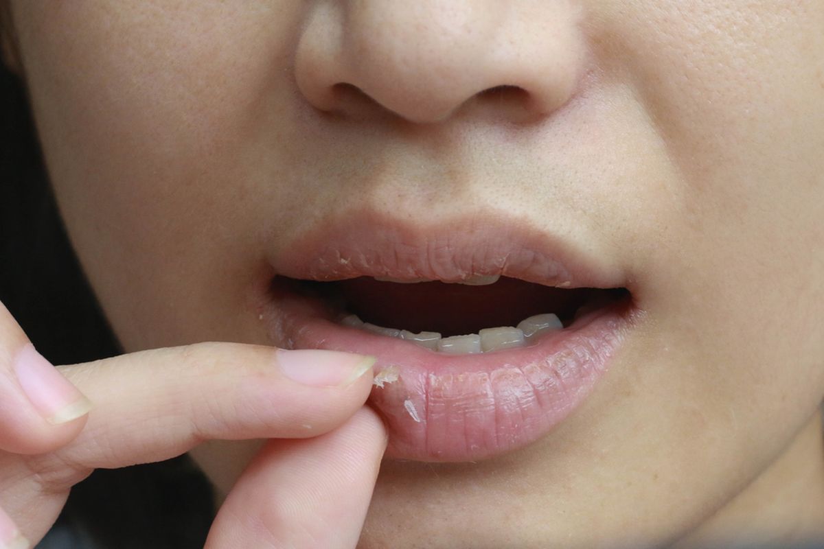 Cara Mengatasi Bibir Kering : Rahasia untuk Senyum Menawan Cara Mengatasi Bibir Kering : Rahasia untuk Senyum Menawan