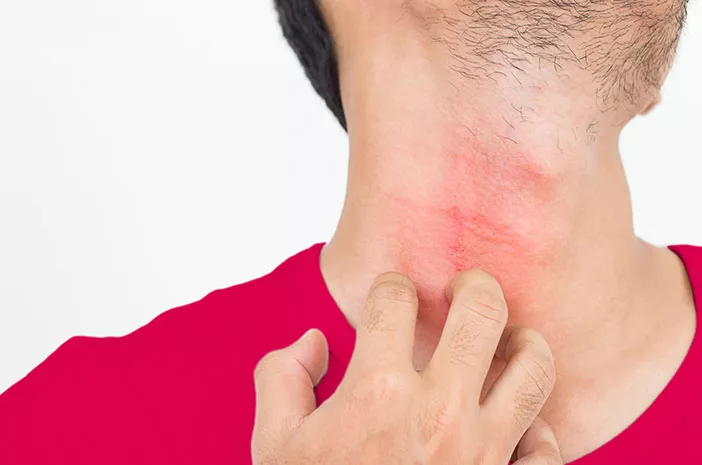 Cara Ampuh Mengatasi Alergi Dingin Cara Ampuh Mengatasi Alergi Dingin