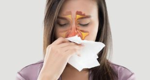 Cara Mengatasi Sinusitis dengan Mudah dan Efektif