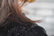 Tips Mengurangi Ketombe Pada Rambut dengan Cepat dan Mudah