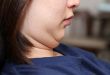 Resep Alami untuk Mengatasi Double Chin