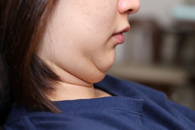 Resep Alami untuk Mengatasi Double Chin Resep Alami untuk Mengatasi Double Chin